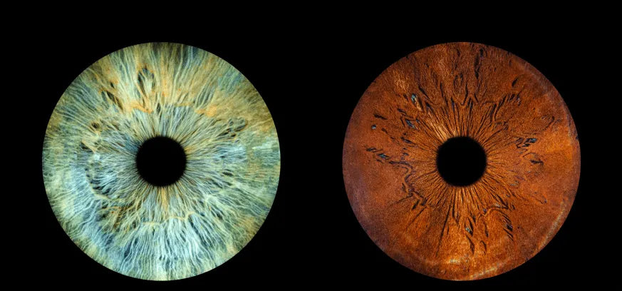 doppelte Iris
