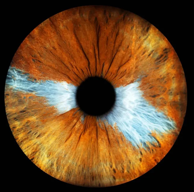 mixed brown and blue iris